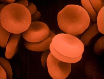 What raises hemoglobin best?