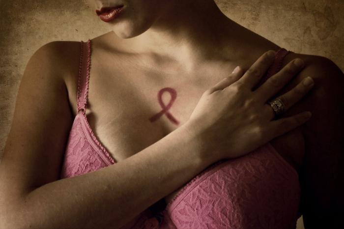 treatment of breast cancer in Israel