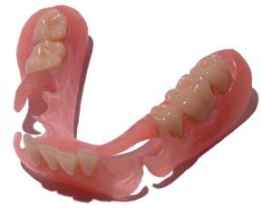 Nylon dentures. Patient Reviews